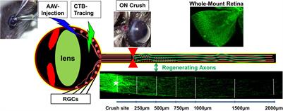 Coordination of Necessary and Permissive Signals by PTEN Inhibition for CNS Axon Regeneration